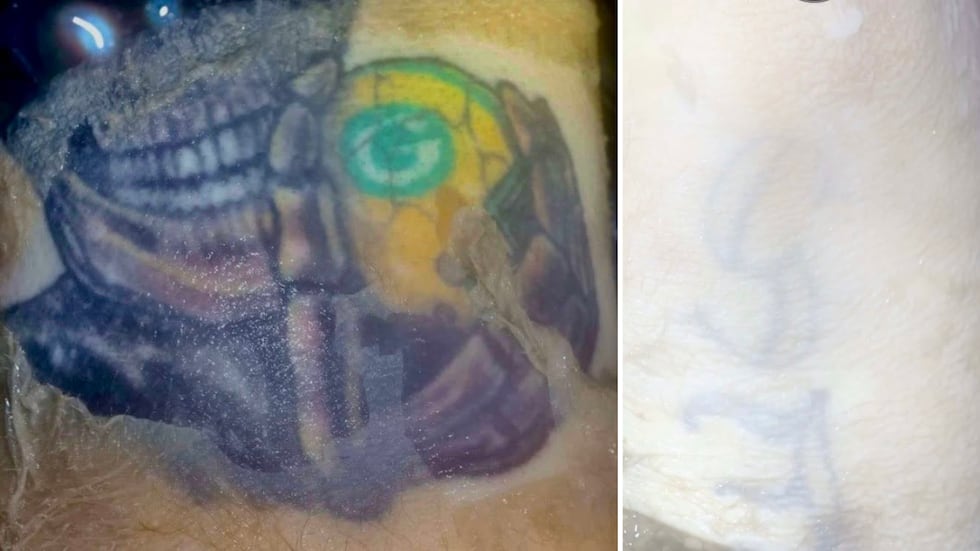 Tattoo of a skeleton holding a Green Bay Packers helmet (left). Tattoo of unknown...